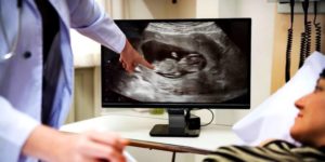 Femme regardant une échographie chez le médecin